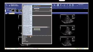 peerVue QICS Peer Review Demo (McKesson)