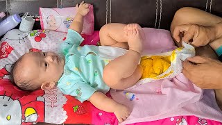 Daddy Change Diaper Village Baby's - Baby Poops a lot❗ Diaper Change of 4 Month Baby Tasya
