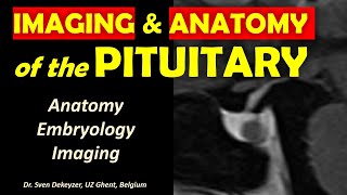 Anatomy and Imaging of the Pituitary Gland