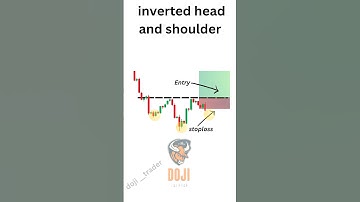 head and shoulder pattern #trading #stockmarket #sharemarket