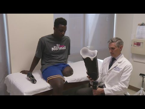 Healthwatch - Advancing Artificial Limbs