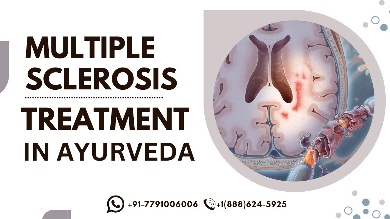 Multiple Sclerosis Treatment in Ayurveda || Best Treatment of Multiple Sclerosis (MS)