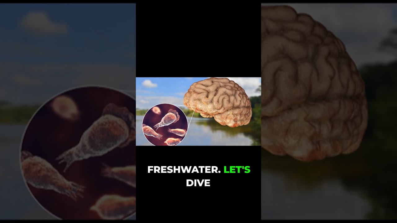 Brain-Eating Amoeba: The Microscopic Killer!