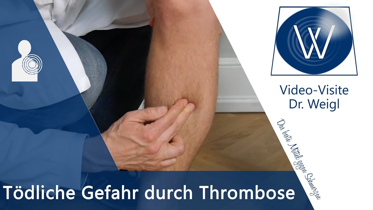 Thrombose - Diagnostik, Therapie und Prophylaxe - Steigerwaldklinik Burgebrach