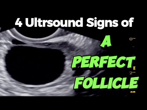 A Perfect Follicle