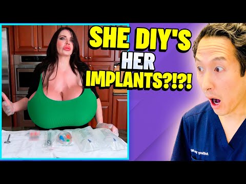 Plastic Surgeon Reacts to LARGEST Implants in US! EXTREME Bodies Explained!