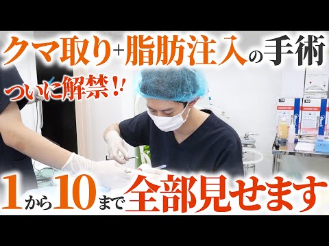 施術動画】クマ取り+脂肪注入の手術を大公開！術後の経過やダウン