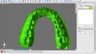 BlueSkyPlan Ortho v4.2.5 - (2) - Model Cleanup