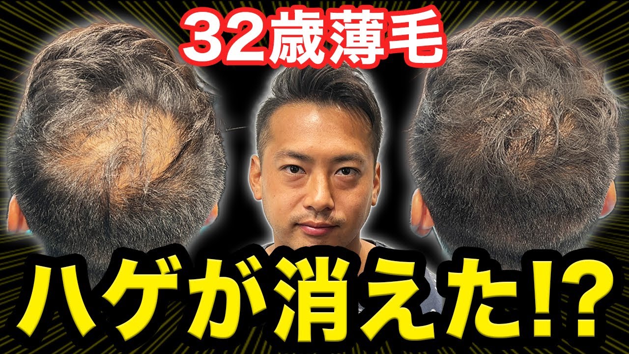 HERS 8月号 髪のためにできること全て Thinning hair in your 30s] Transform your hair with a hairstyle