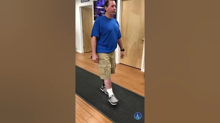 Charles' Prosthetic Training