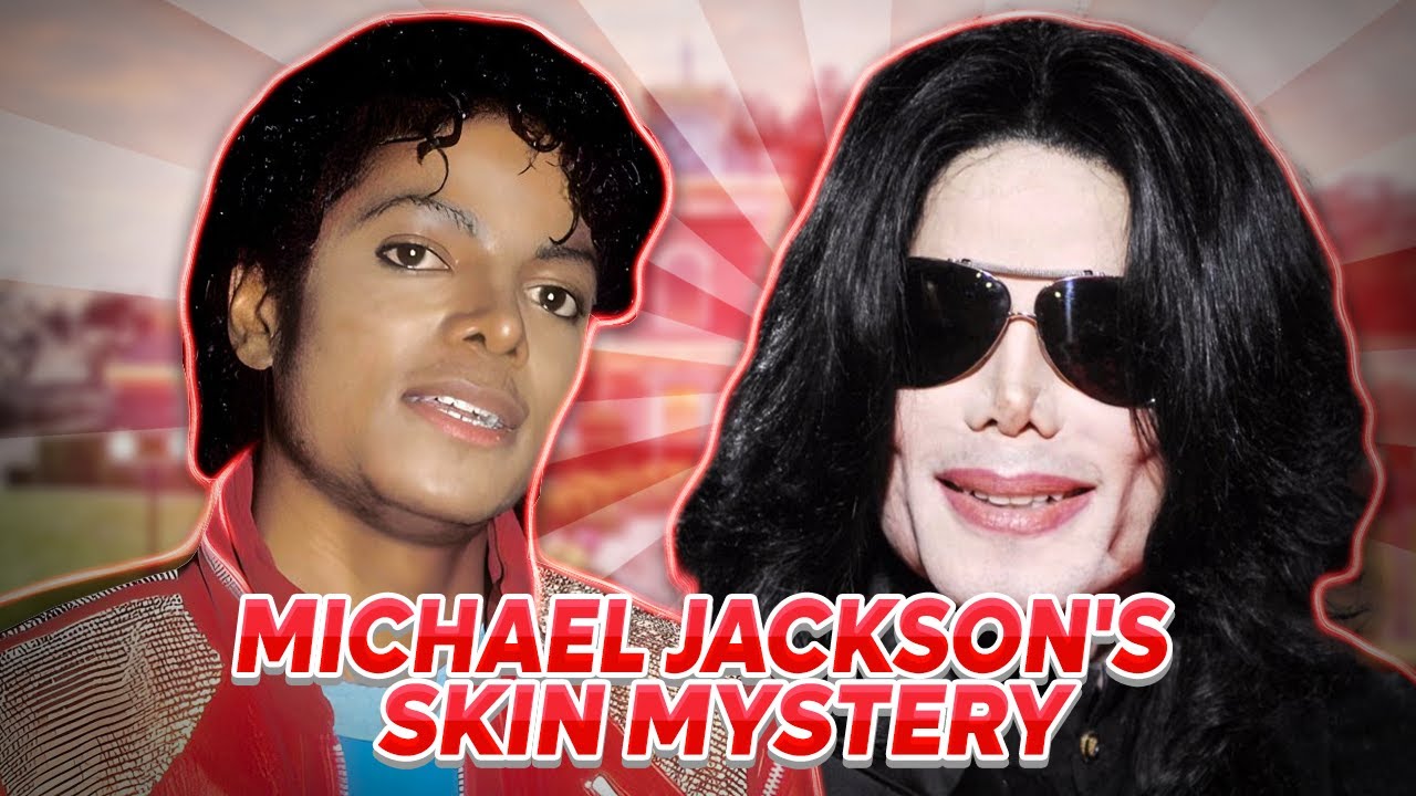 Michael Jackson's Skin Transformation From Black To White - The Real ...