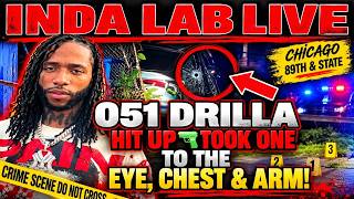 051DRILLA TAKES SHOTS TO THE EYE CHEST AND ARM CONDITION CRITICAL IS THIS GET BACK#CHIRAQ  📱