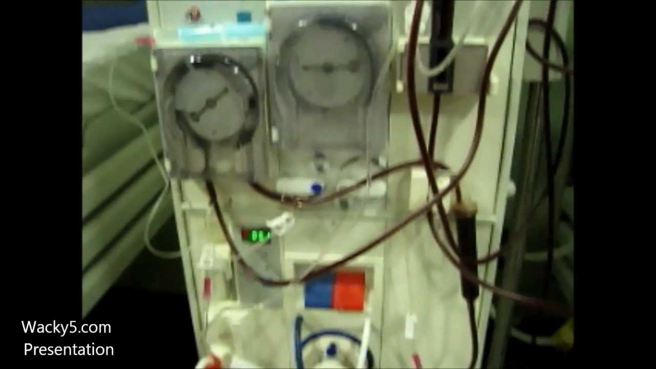 Dialysis Machine Parts And Indications Of Dialysis - YouTube