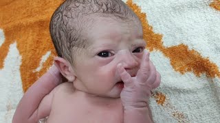 Prettiest Upper lip Birth Mark of Newborn baby Girl just after birth #birthmark #baby