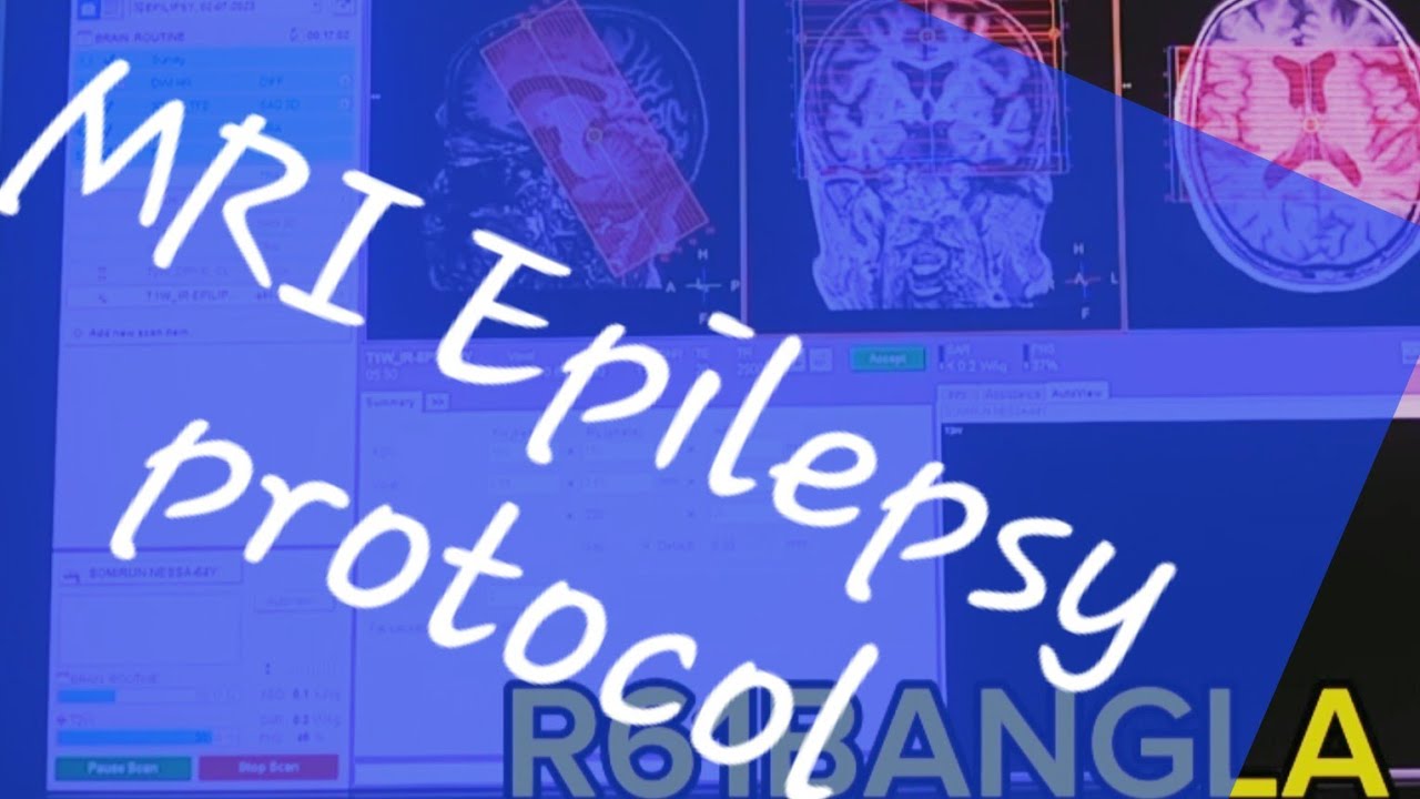 Bangla MRI Brain Epilepsy Protocol And Planning philips 3T mri YouTube bangla-mri-brain-epilepsy-protocol-and-planning-philips-3t-mri-youtube