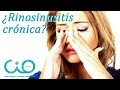 Rinosinusitis crónica | CIO Bilbao | Otorrinos especialistas