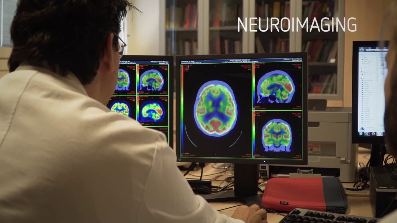 Il centro dei disturbi cognitivi e delle demenze  del Policlinico