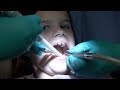 DENTAL HEALTH VLOG | HER FIRST CAVITY FILLING | DOES IT HURT?