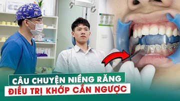 Gắn Mắc Cài Điều Trị Khớp Cắn Ngược | Câu Chuyện Thay Đổi Nụ Cười