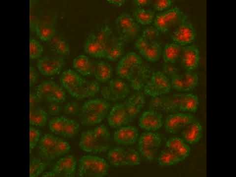 Mouse kidney culture, embryonic day 13.0, showing uteric bud cells and nephron progenitor cells