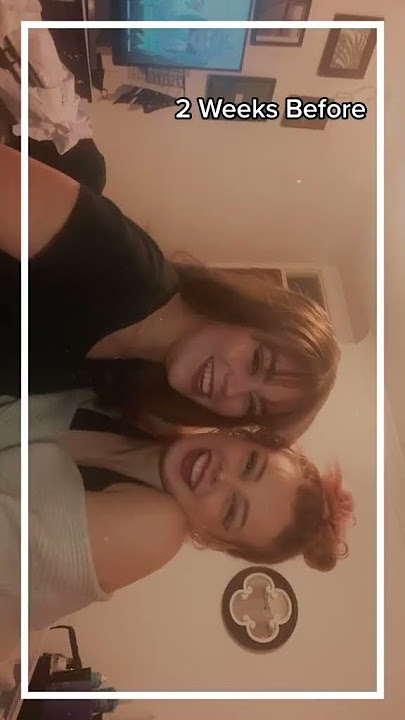 You can always see then signs of someone suffering #mentalhealth #sad #depressed #gethelp