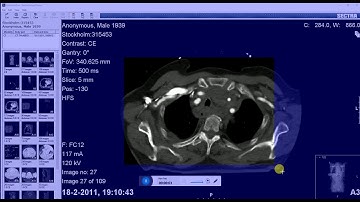 Rad2Share - Export your PACS images directly to Powerpoint or JPEG
