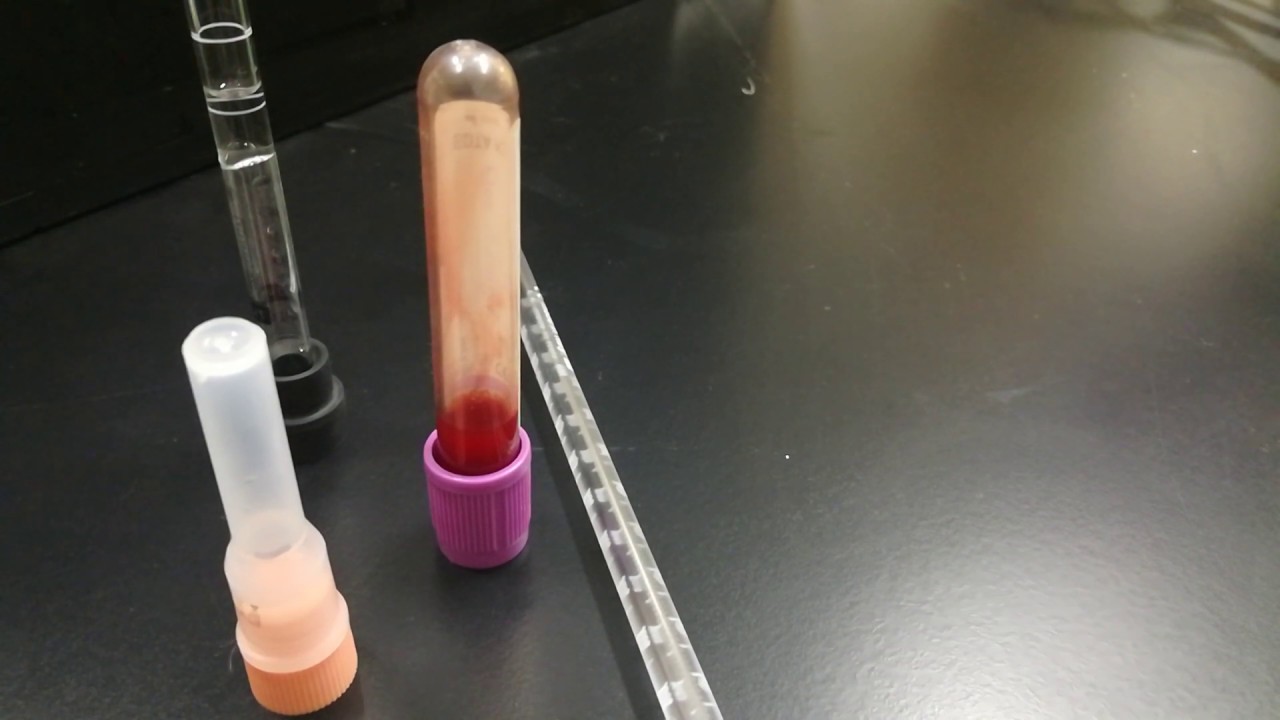 كيفية إجراء تحليل esr سرعة ترسيب الدم الجزء الأول