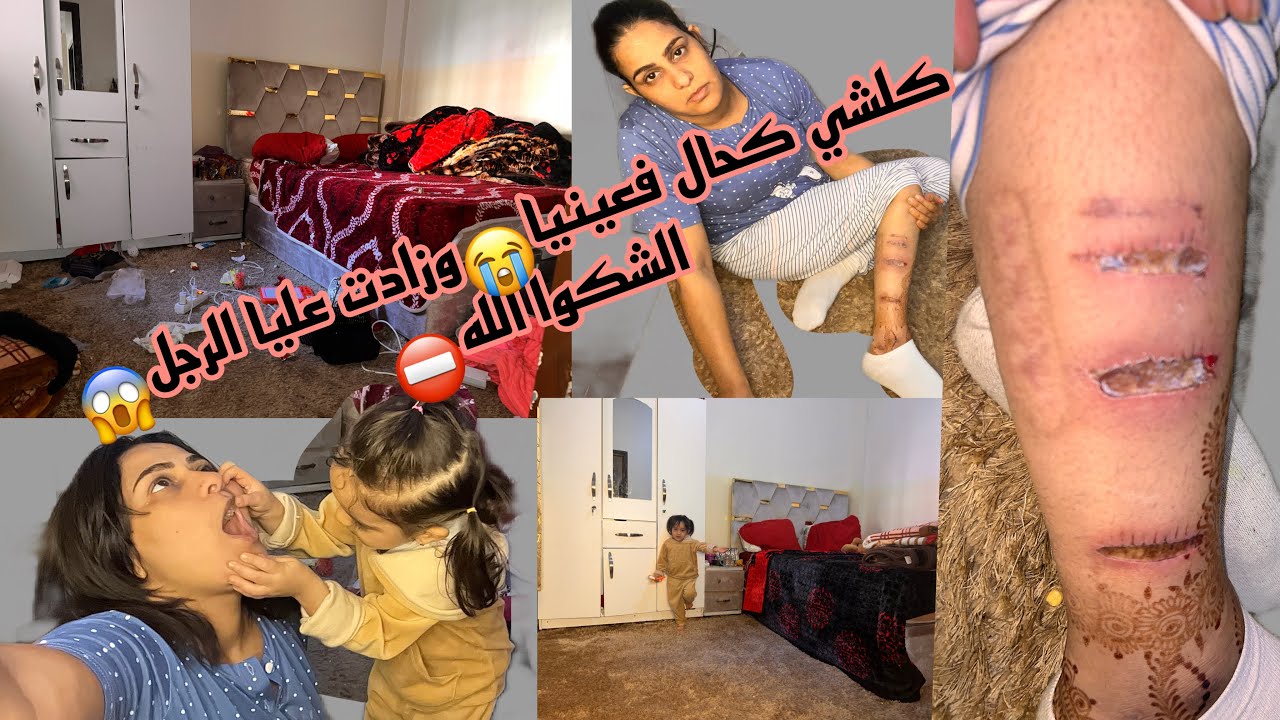 هجمو عليا ومرحمونيش😑سبب لي خلا رجلي هاكا 😱آخر حاجة كنت نفكر فيها وقعات ليا❌ضمرت وفشلت😭