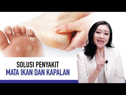 Video: Apakah yang menyebabkan pustula pada kaki?