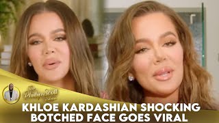 Khloe Kardashian Shocked Fans After Posting A Video Of Her Botched Face