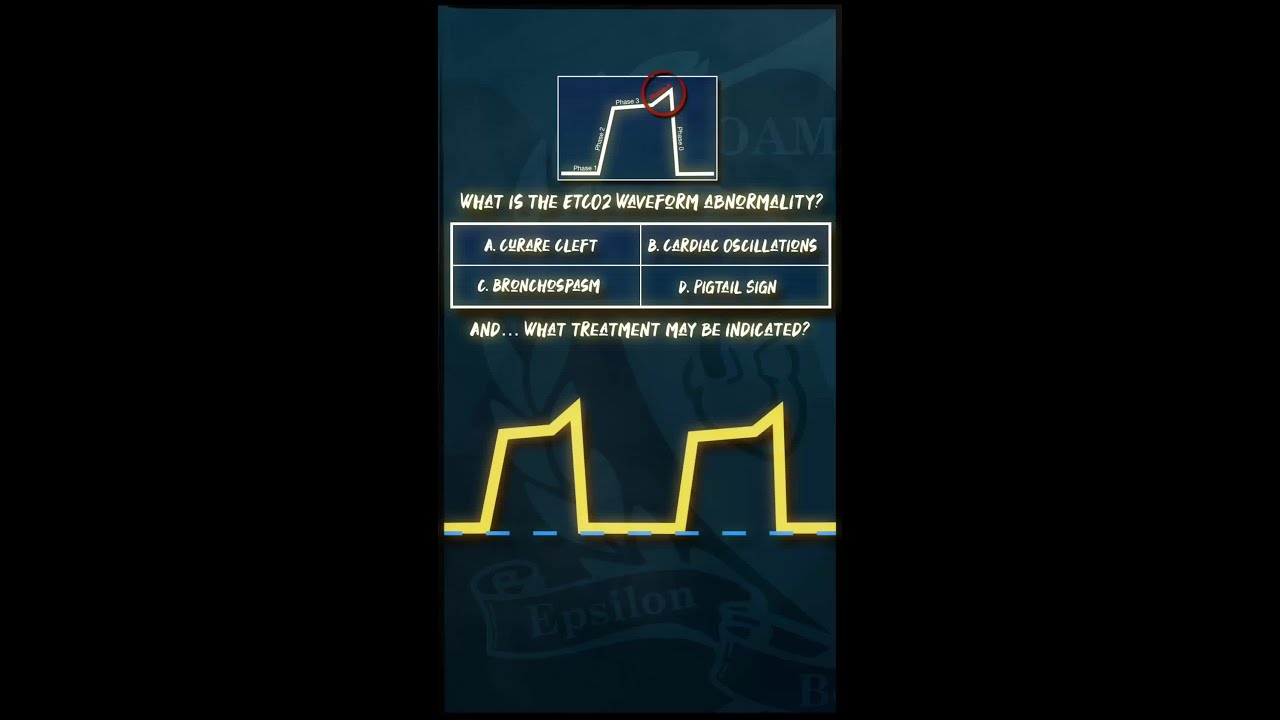 Whats the waveform show?