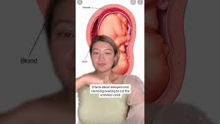 3 Facts About Delayed Cord Clamping