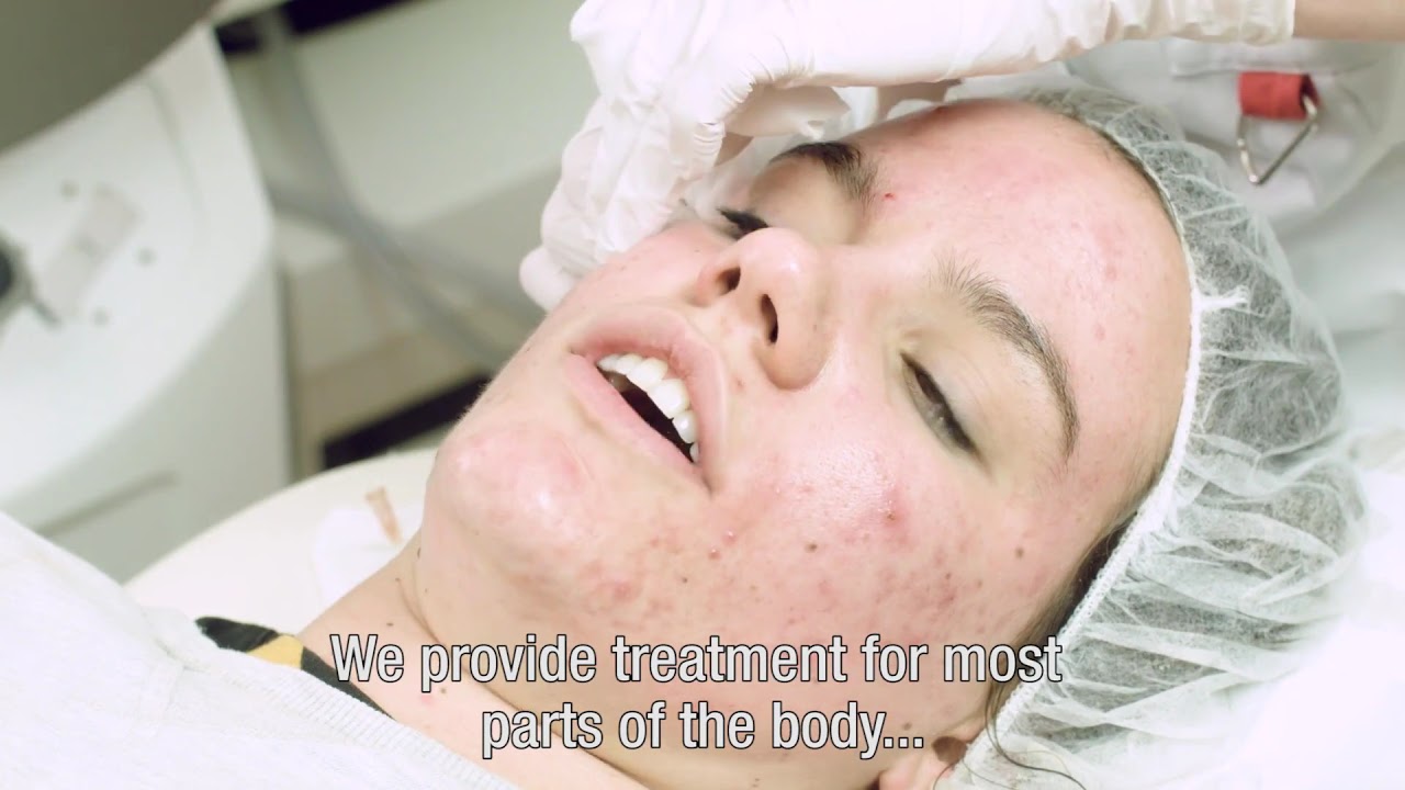 Acne behandeling / Acne treatment