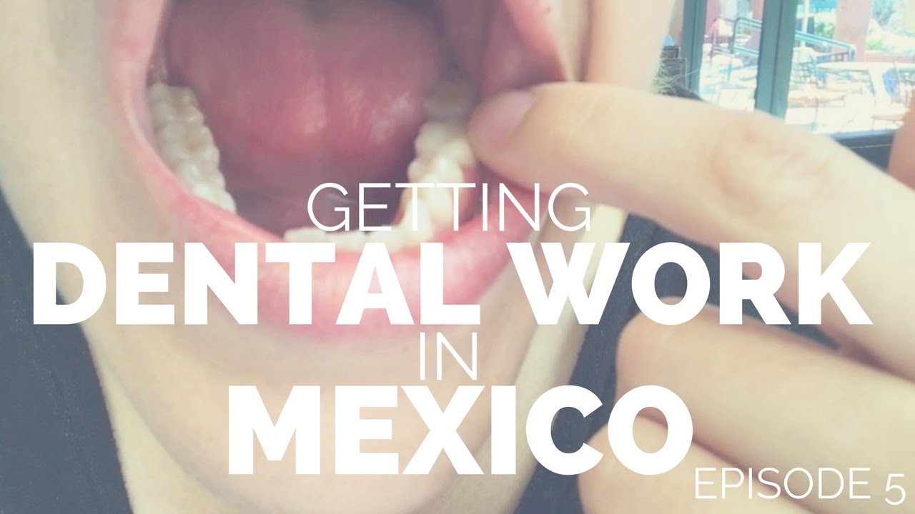 GETTING DENTAL WORK IN MEXICO - Episode 5 - YouTube