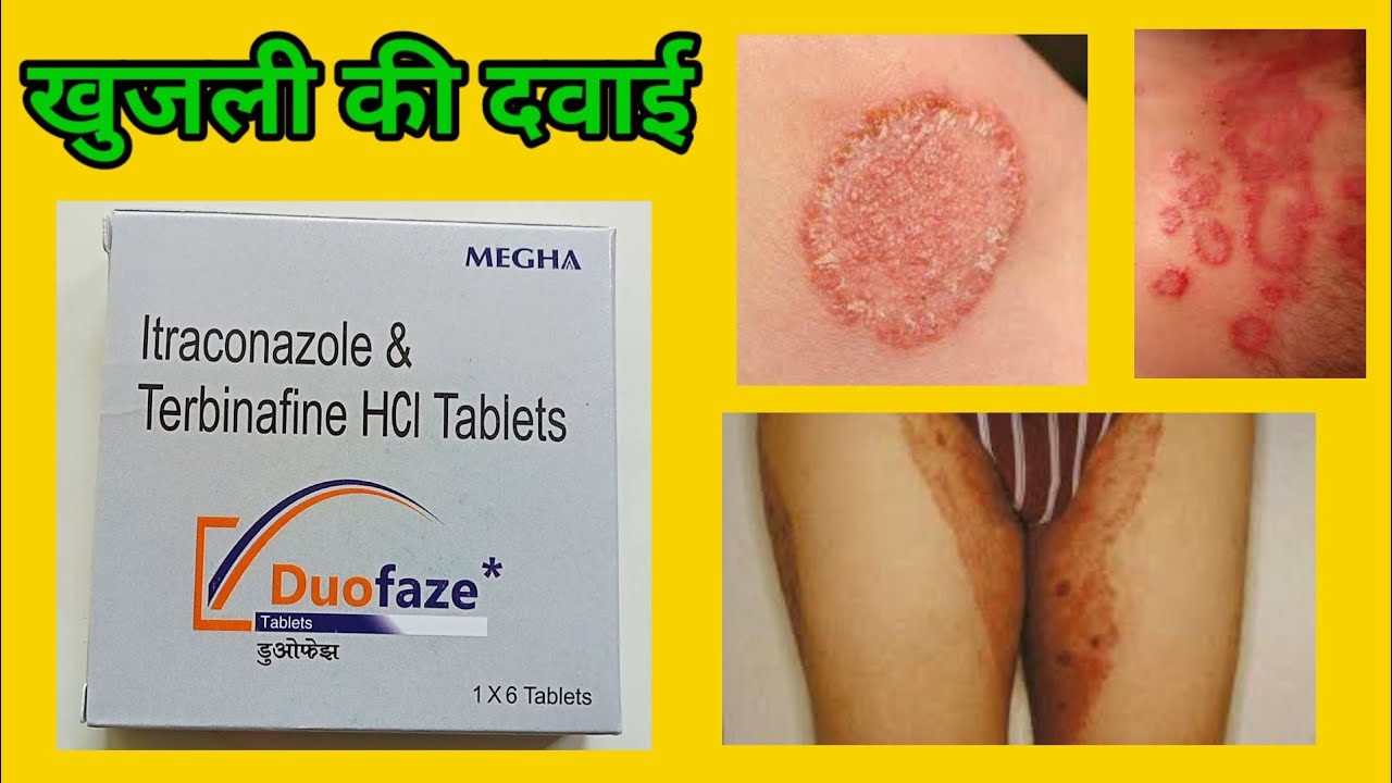 Duofaze Tablet | Itroconazole and Terbinafine HCl Tablet | Dad Khaj khujli ki tablet | दाद खाज