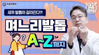 새끼발가락 통증을 유발하는 며느리발톱! 간단한 치료로 통증 Bye~