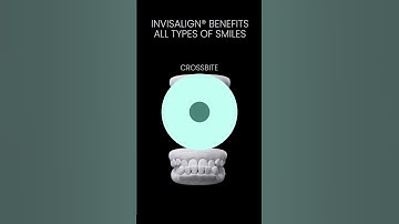 Transform Your Smile with Invisalign