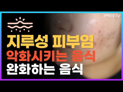 가렵고 따가운 &amp;#39;지루성 피부염&amp;#39;에 좋은 음식 vs 나쁜 음식