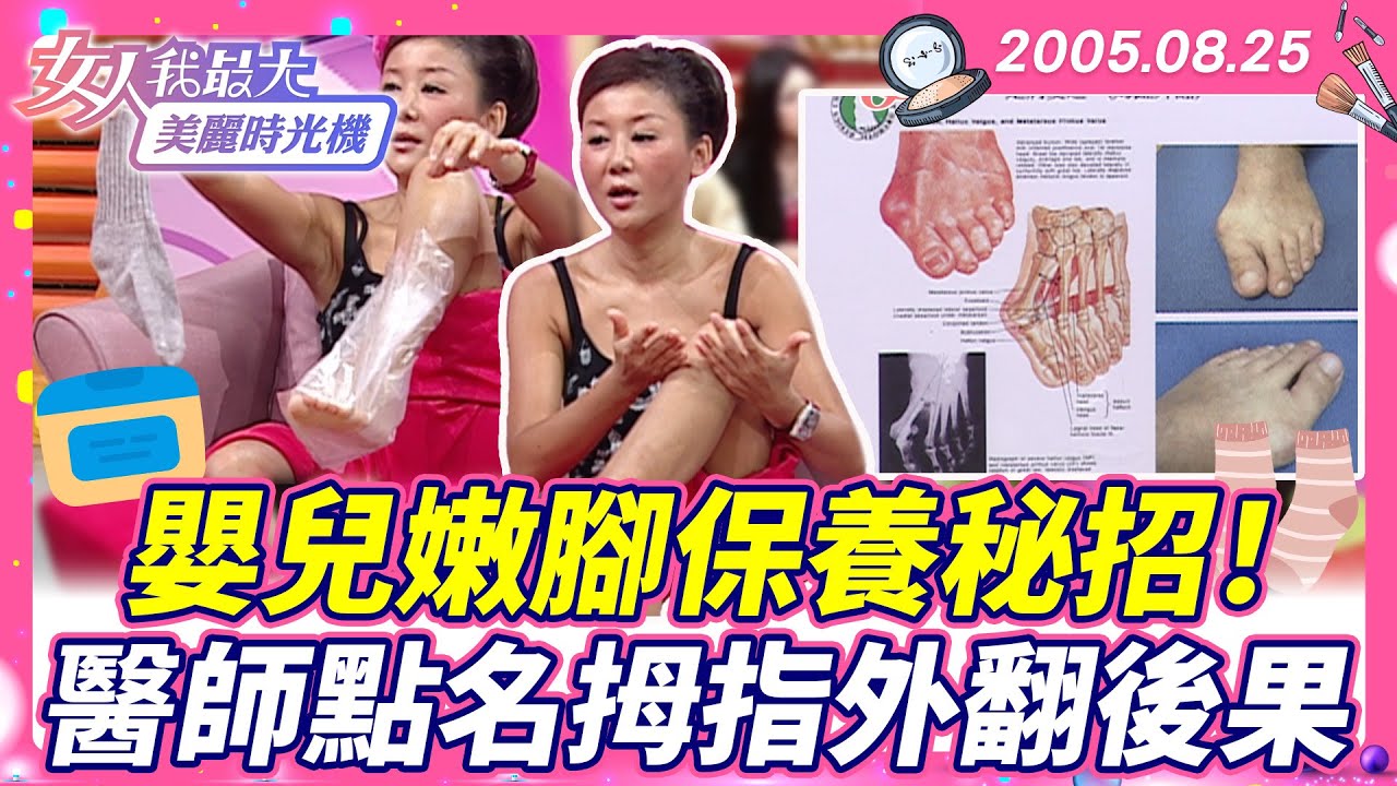 嬰兒嫩腳保養秘招！醫師點名拇指外翻後果#藍教主 #腳部 #保養 #拇指外翻【#女人我最大 X #美麗時光機】數位修復版