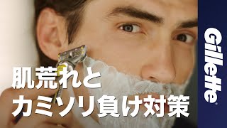 剃った後の肌荒れやカミソリ負けしない方法｜フュージョン5+1 プロシールド｜ジレットジャパン