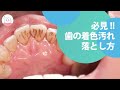 気になる着色汚れを落とす!!エアフロー Remove Stains On Teeth! Air-Flow