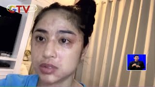 Terpapar COVID-19, Dewi Persik Alami Ruam di Sekujur Tubuh - BIS 26/12