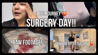 Surgery day with Dr.Brewster!|Tips to get ready for surgery!First few hrs after surgery!