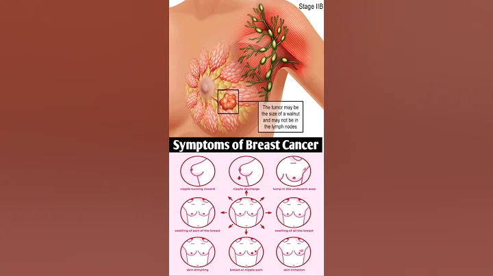 #short #mbbs #doctor #biology #aiims #pregnancy #neet #anatomy #breastcancer #viral #breastfeeding