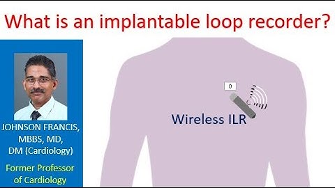 What is an implantable loop recorder?