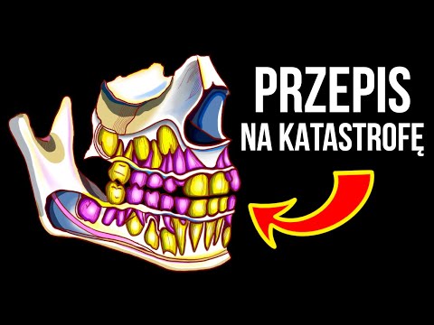 Wideo: Czy Twój Pies Potrzebuje Dentysty – Luty To Miesiąc Zdrowia Zębów?