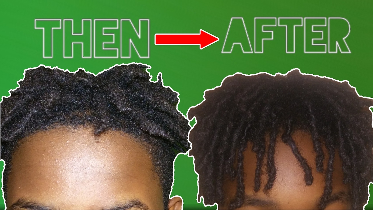 high-top-dreads-5-tips-to-make-your-dreadlocks-grow-faster-youtube