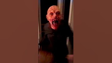 Day 27 of opening cases until I get butterfly knife