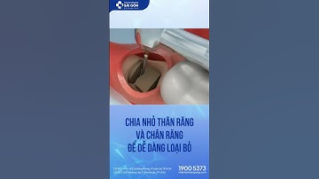 Nhổ Răng Khôn Mọc Ngầm Ra Sao? | Nha Khoa Trồng Răng Sài Gòn  #nhakhoatrongrangsaigon #rangkhon