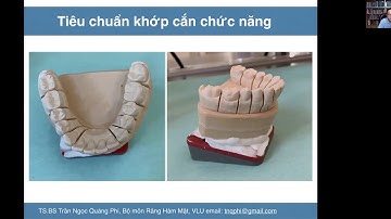 Tiêu chuẩn khớp cắn chức năng